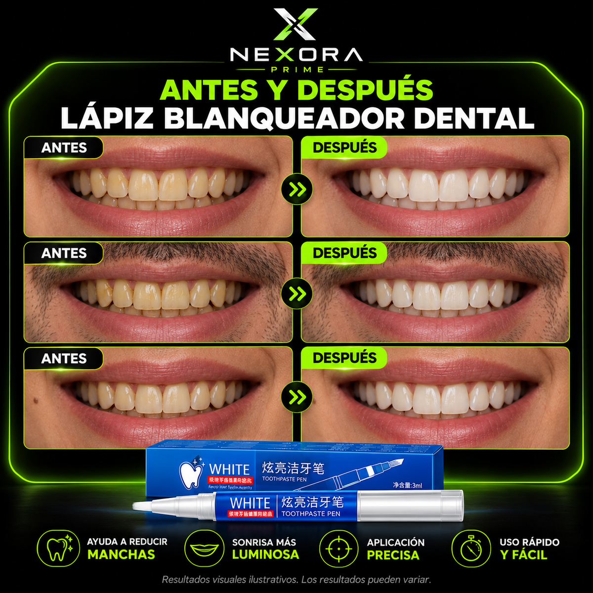 🦷¡DIENTES MÁS BLANCOS EN MINUTOS!✨+Envío Gratis🏡🚚