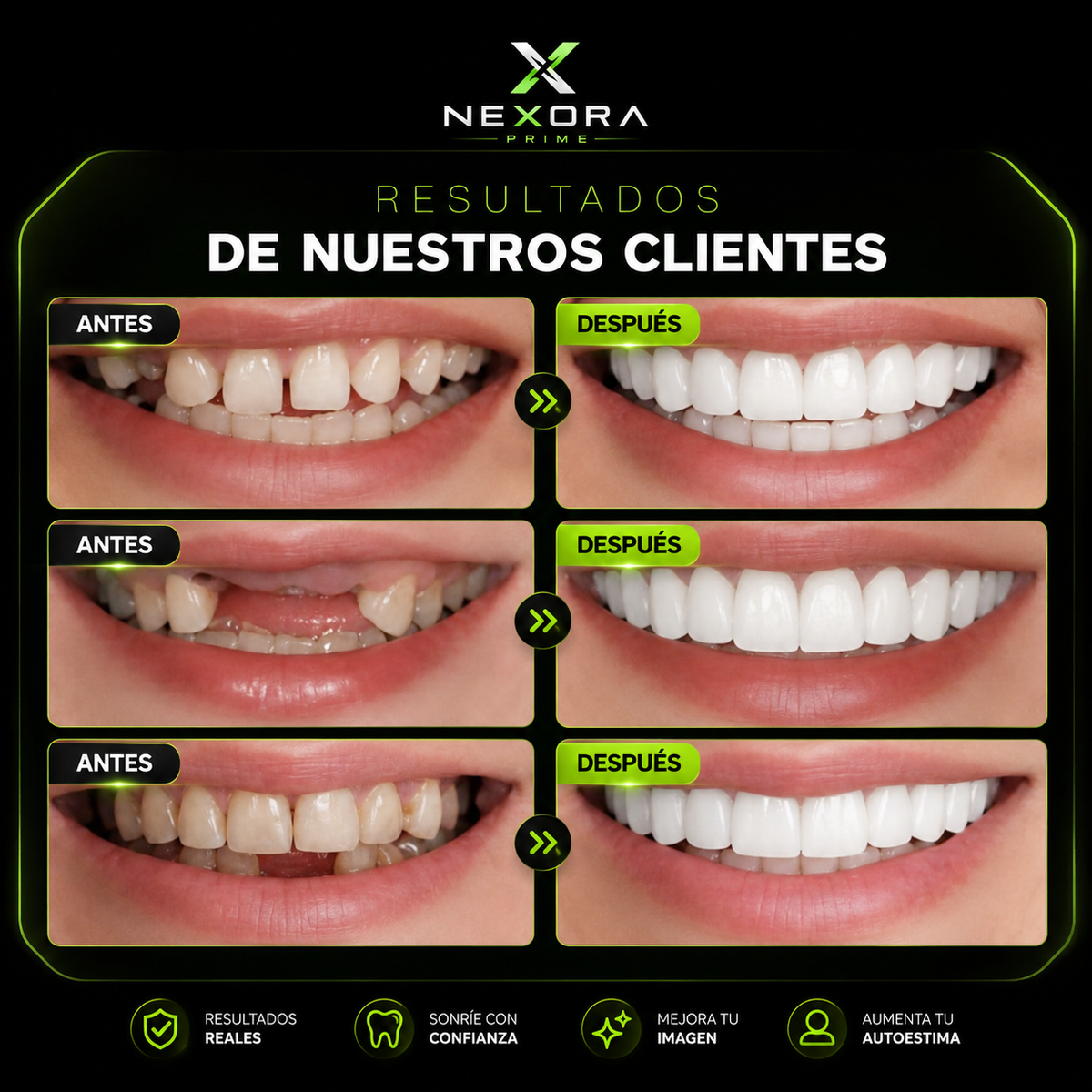 💚VUELVE A SONREIR CON CONFIANZA✨ 2X1 +Envío Gratis🏡🚚