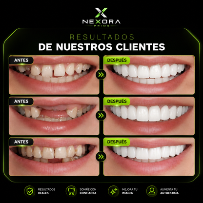 💚VUELVE A SONREIR CON CONFIANZA✨ 2X1 +Envío Gratis🏡🚚