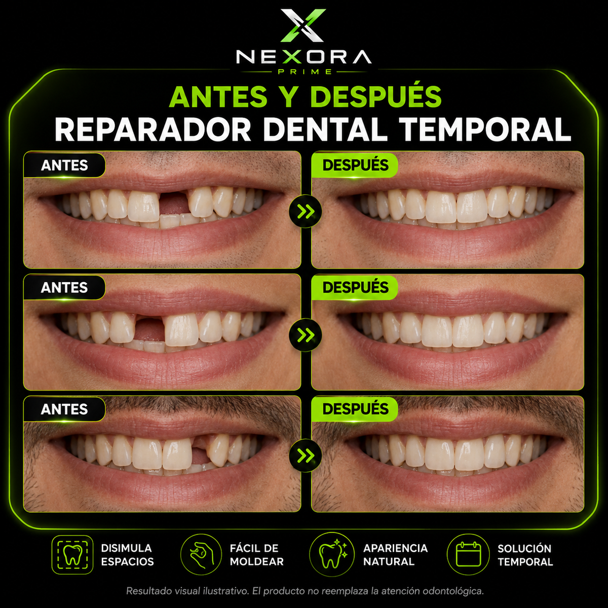 Kit de molde dental🦷¡Sonríe desde hoy con más confianza!😁+Envío Gratis🏡🚚